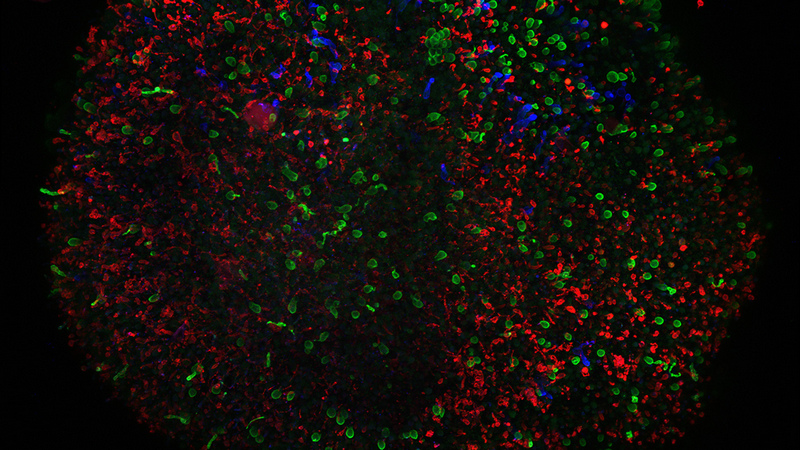 Scientists Grow Tiny Human Retinas in a Dish