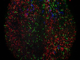 Scientists Grow Tiny Human Retinas in a Dish Scientists Grow Tiny Human Retinas in a Dish