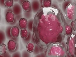 Stem Cell Therapy Offers a New Hope to Repair Brain Damage in Newborns Stem Cell Therapy Offers a New Hope to Repair Brain Damage in Newborns