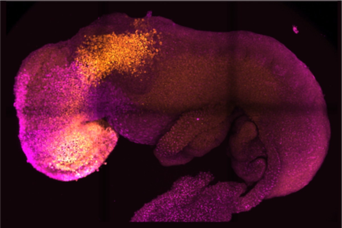 Synthetic Mouse Embryo With Developed Brain Grown Using Stem Cells