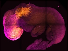 Synthetic Mouse Embryo With Developed Brain Grown Using Stem Cells Synthetic Mouse Embryo With Developed Brain Grown Using Stem Cells