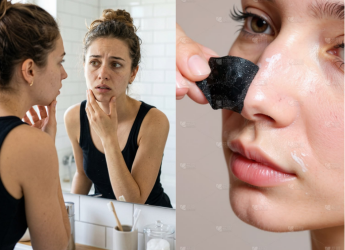 How Can I Remove Blackheads at Home? Products That Actually Work